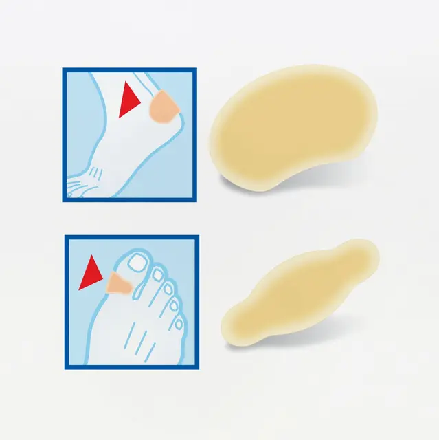 BenPed Blemmeplaster 64x40 mm 6 stk. 