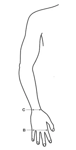 Mobiderm Hanske m/fingre STD 2 Venstre 