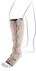 Mobiderm Autofit Knestrømpe